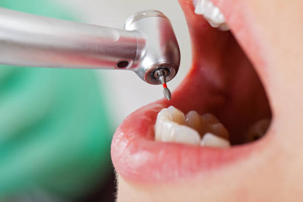 Best Emergency Treatment for Oral Infections in Ross, CA